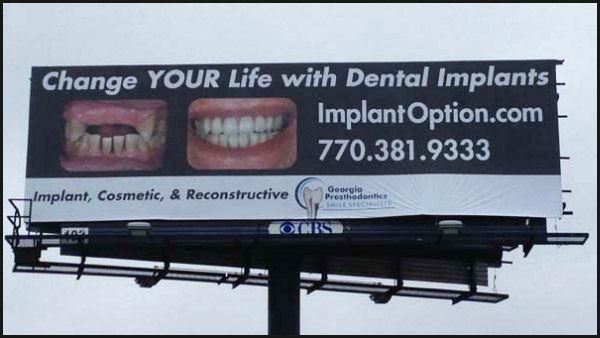 implant billboard